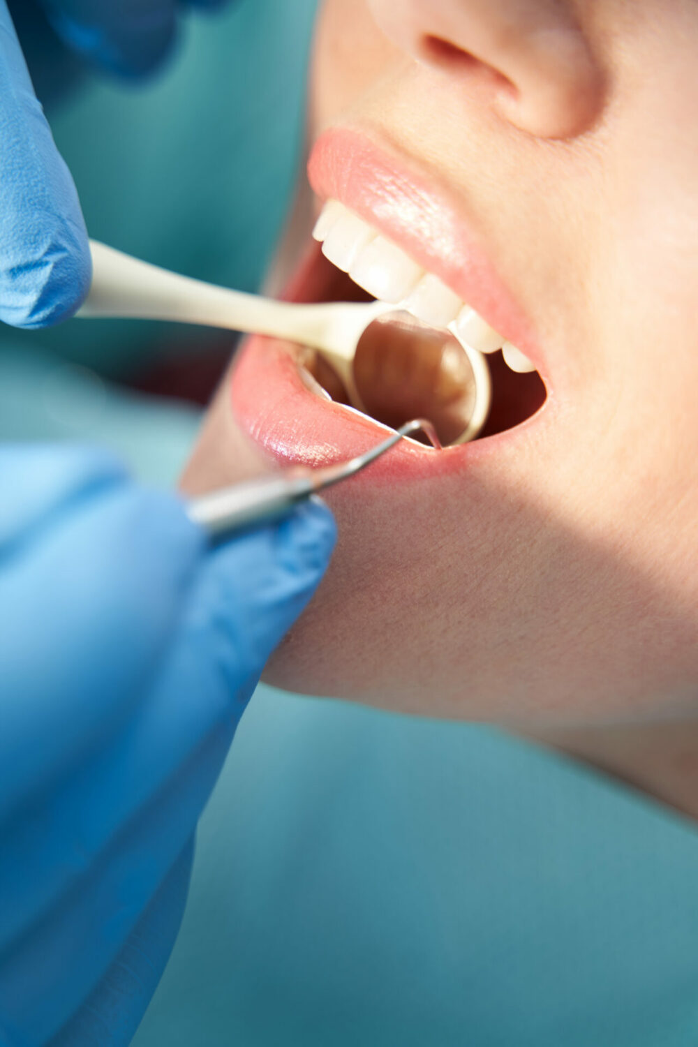 Kensington Dental Care Gentle Adelaide Dentists Kensington Dental Care Gentle Adelaide Dentists
